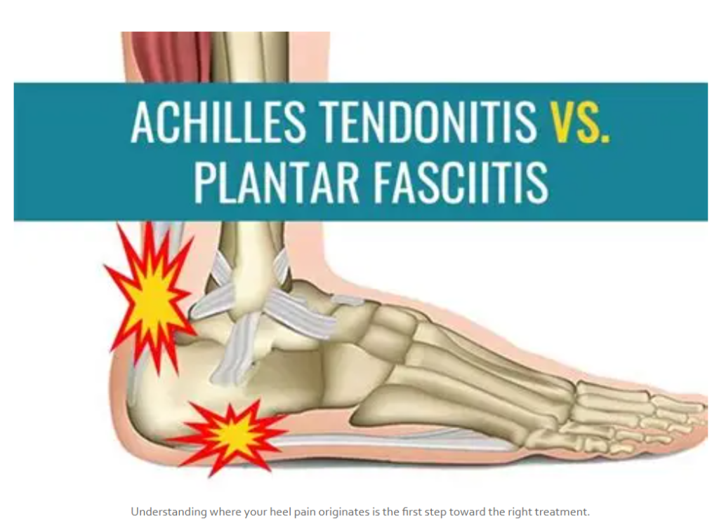 achilles tendonitis treatment in pickleball players